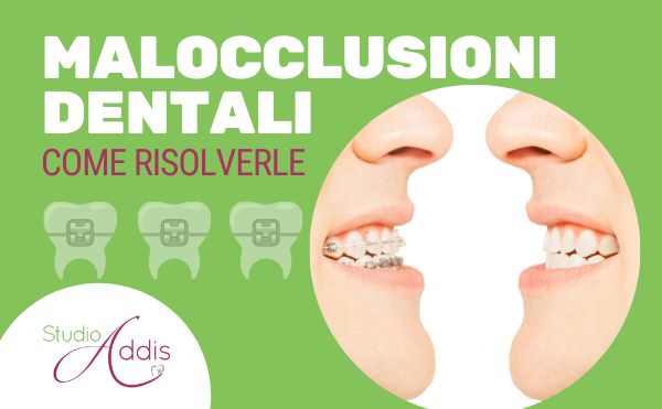 Malocclusioni dentali apparecchio per i denti