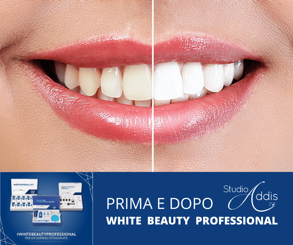 sbiancamento denti porto torres